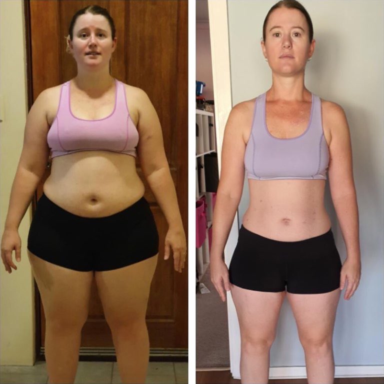 Page 7  93,000+ Bariatric Before After Pictures